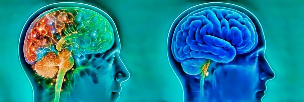 Cortical Remodeling